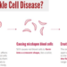 Know The Sickle Cell Disease