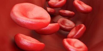 Sickle Cells